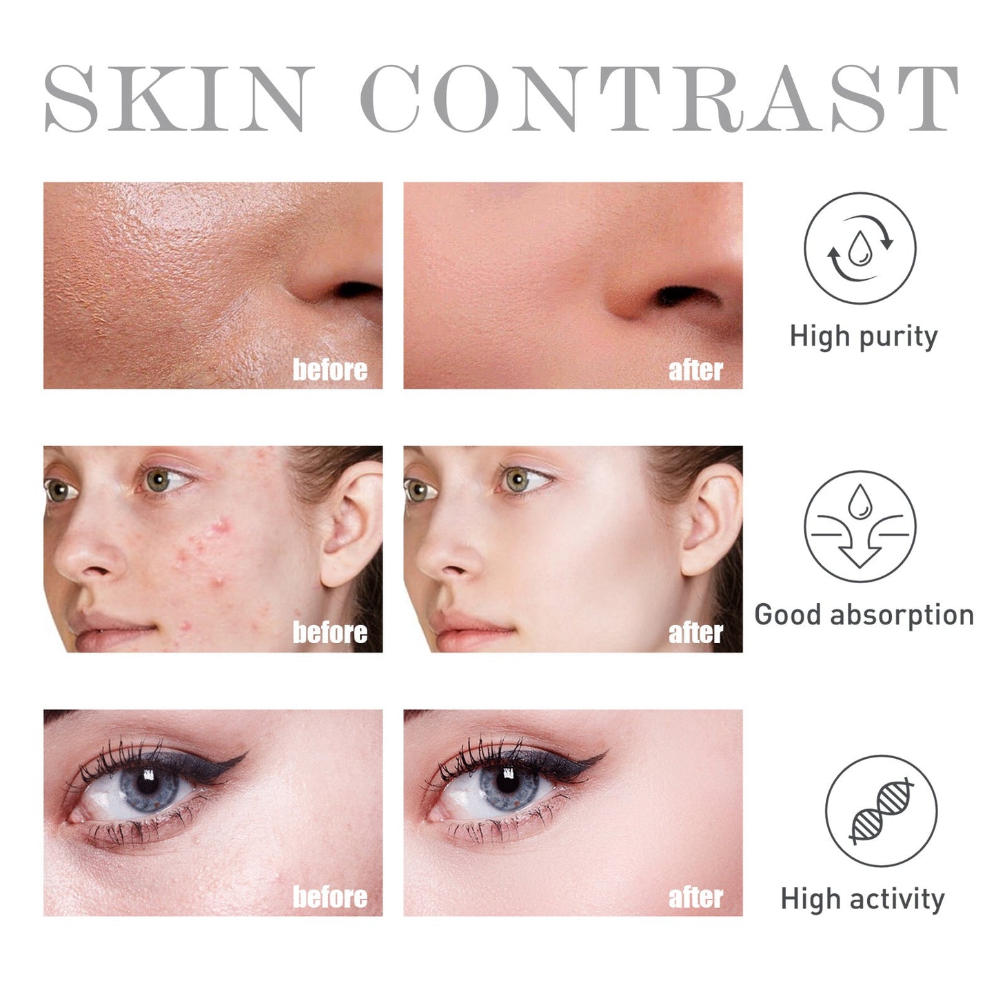 Salicylate Acne Treatment Hydrating Skin Solution