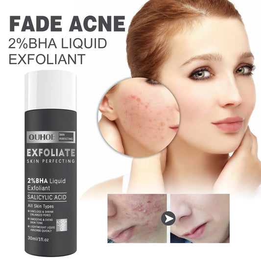 Salicylate Acne Treatment Hydrating Skin Solution