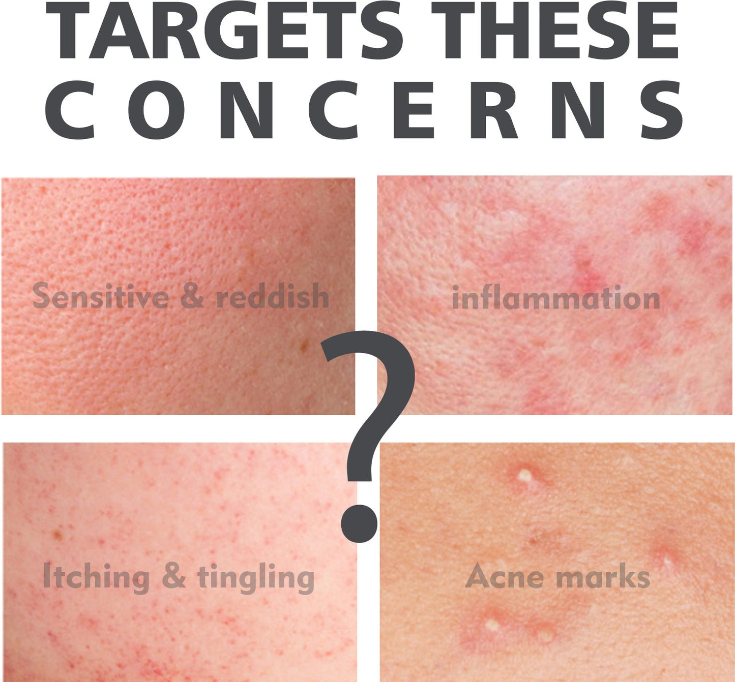 Salicylate Acne Treatment Hydrating Skin Solution